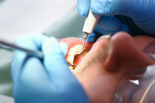 Best Walk-In Emergency Dentist in Elm City, NC